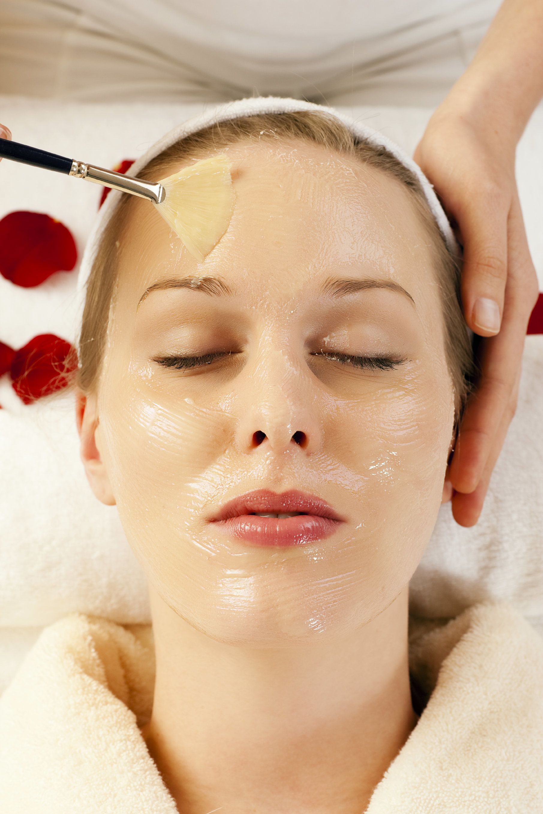 Image of cosmetic chemical peel