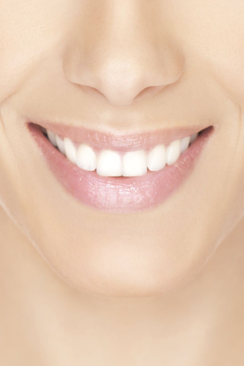 Close up of a woman’s flawless smile after undergoing treatment for chipped teeth