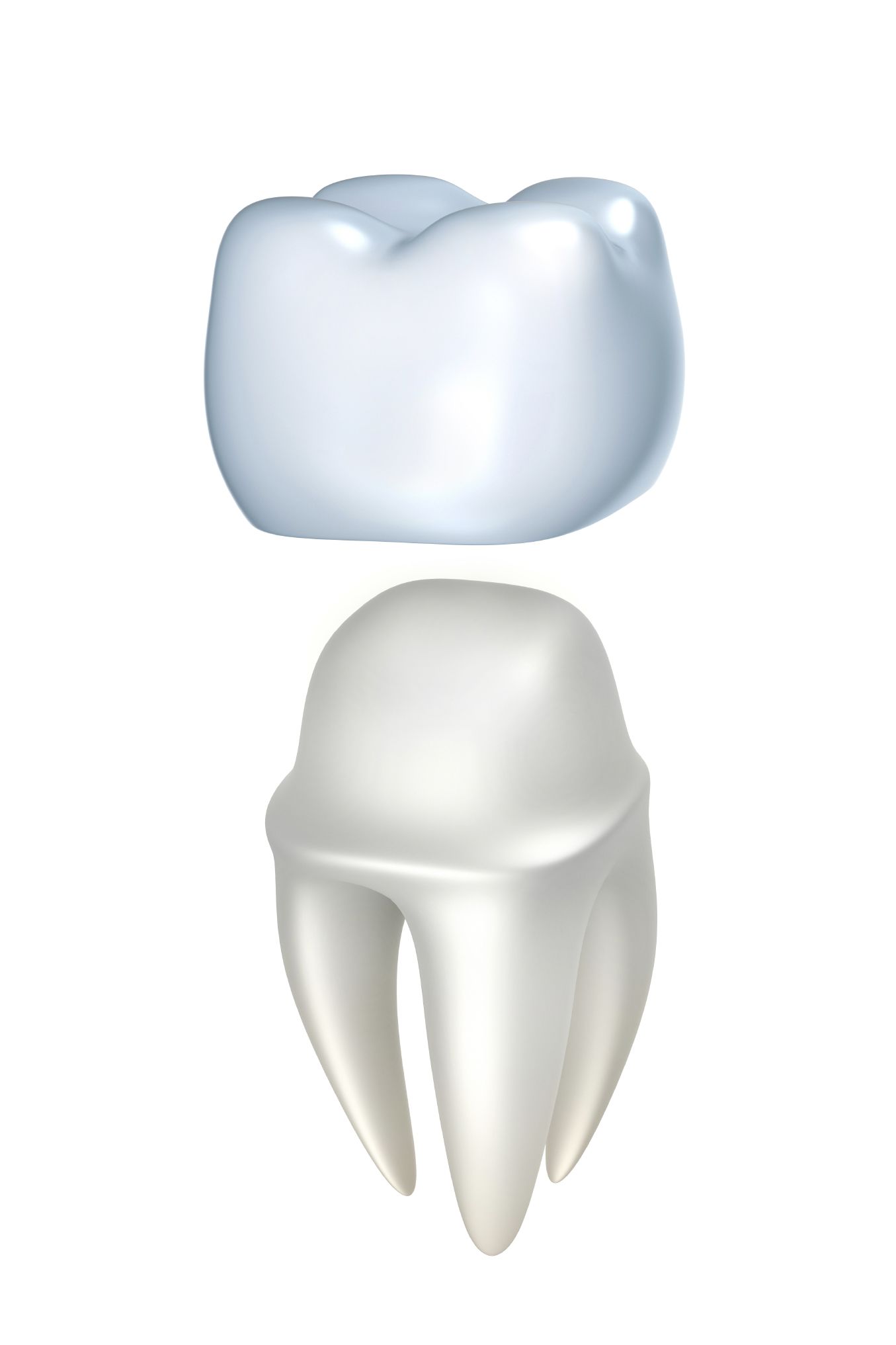 An illustration of a crown over a tooth