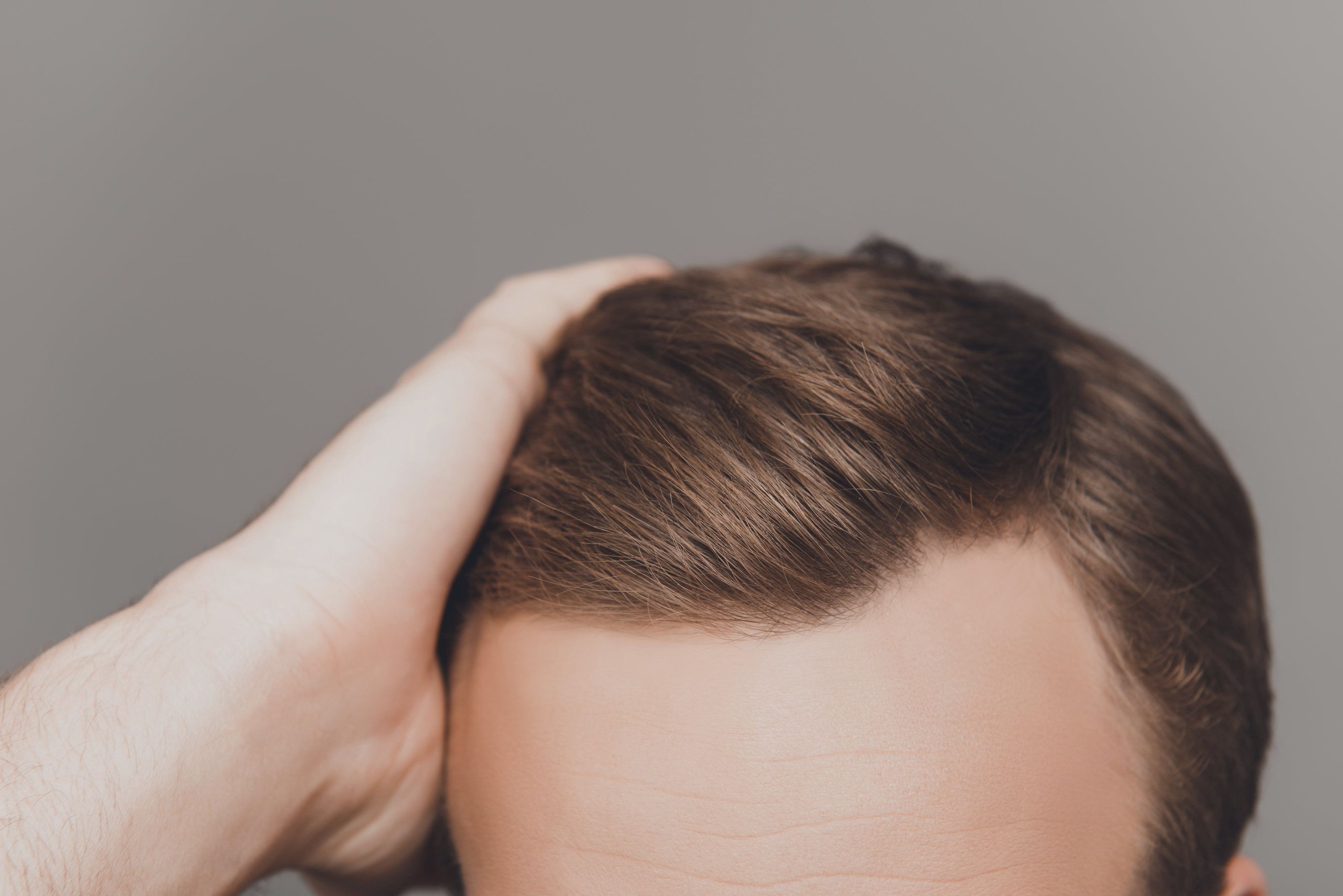 What To Do After A Failed Hair Transplant