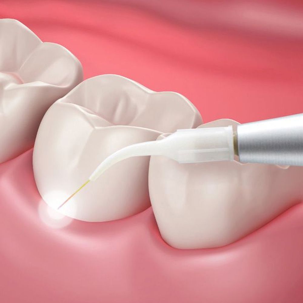 A young couple with healthy gums smiles together