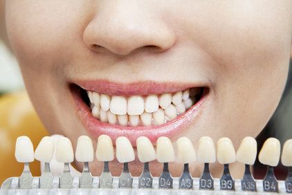 Woman smiling next to enamel shade samples