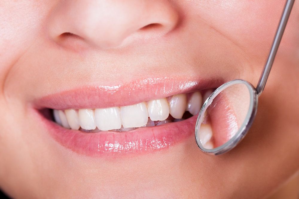 A dental mirror examining a woman’s smile