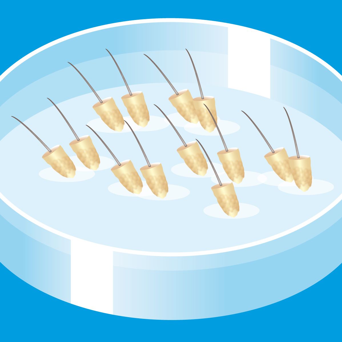 Hair follicles in petri dish