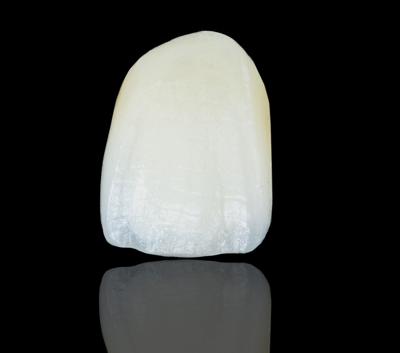 Closeup of a porcelain veneer