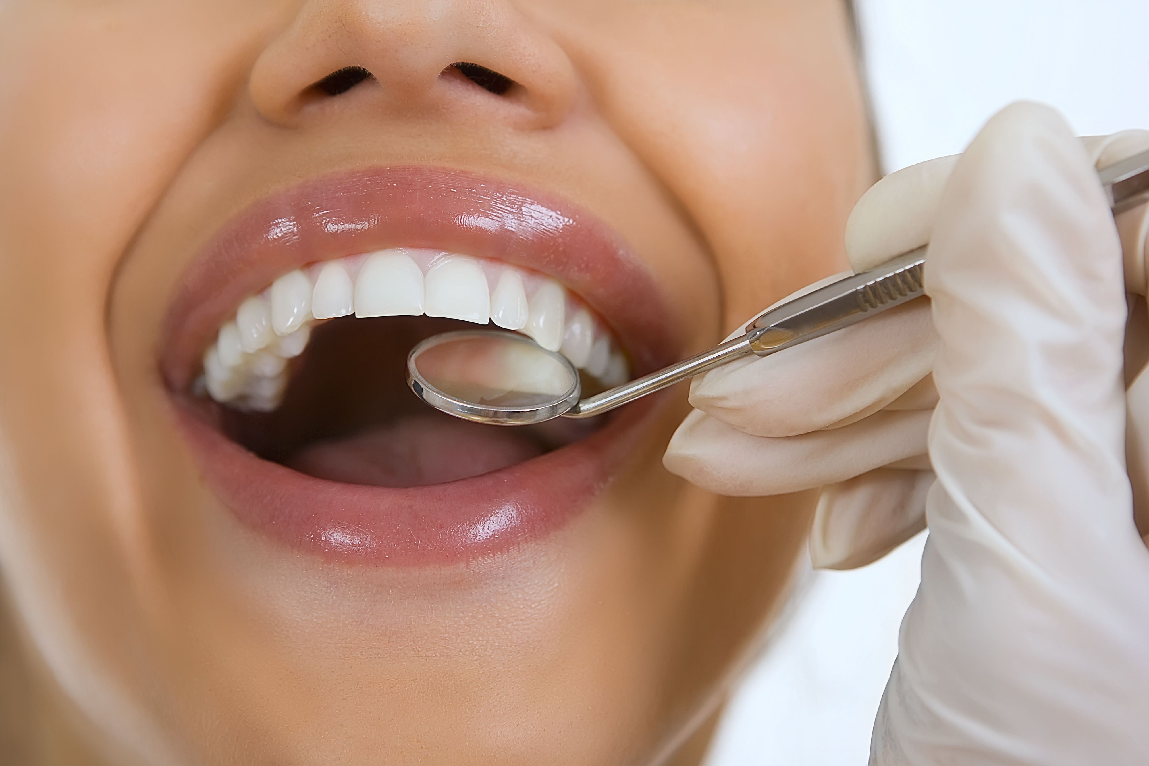 Bright, white teeth being examined