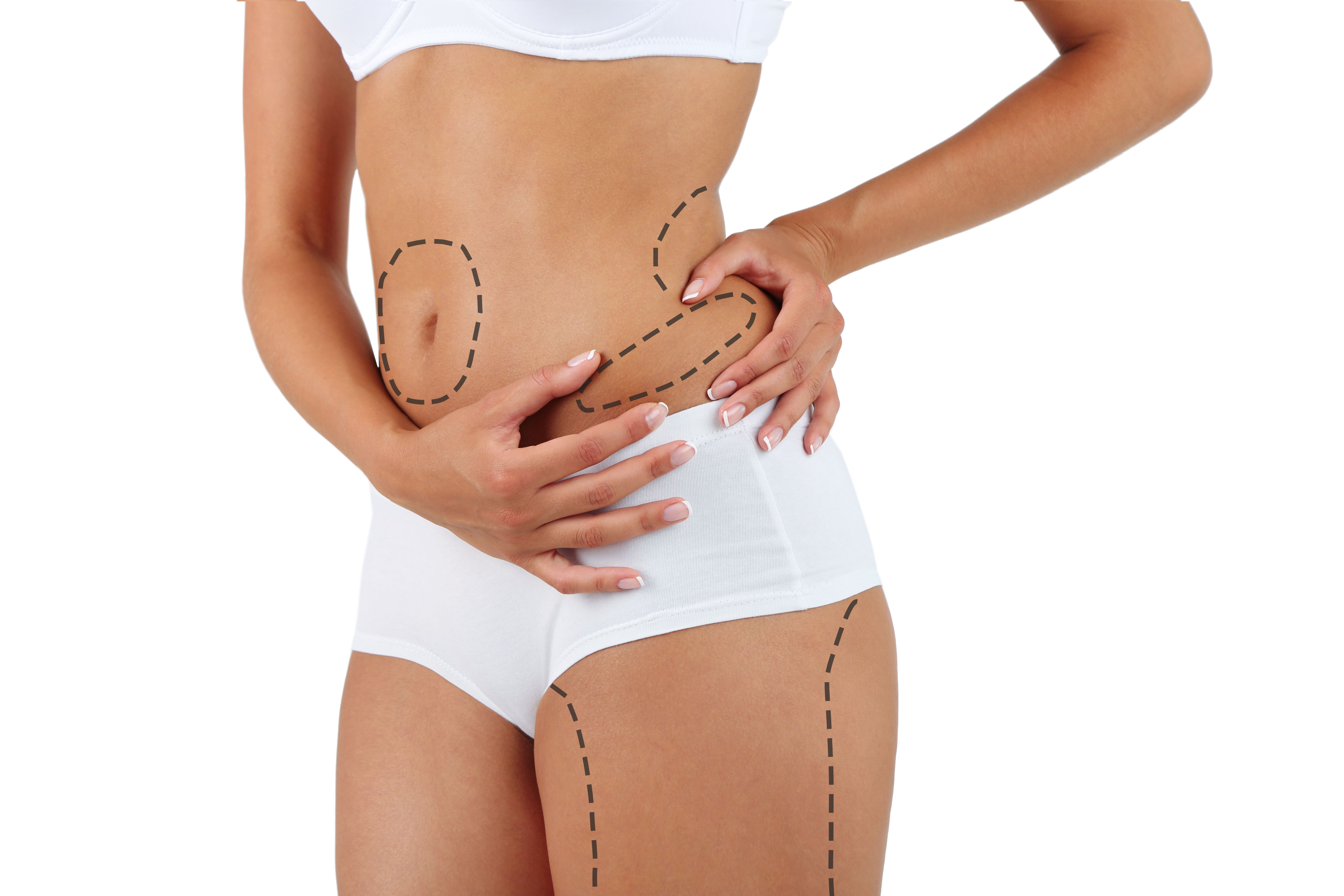 Tummy Tuck Frisco, TX - Plano, TX - North Texas - Frisco Plastic