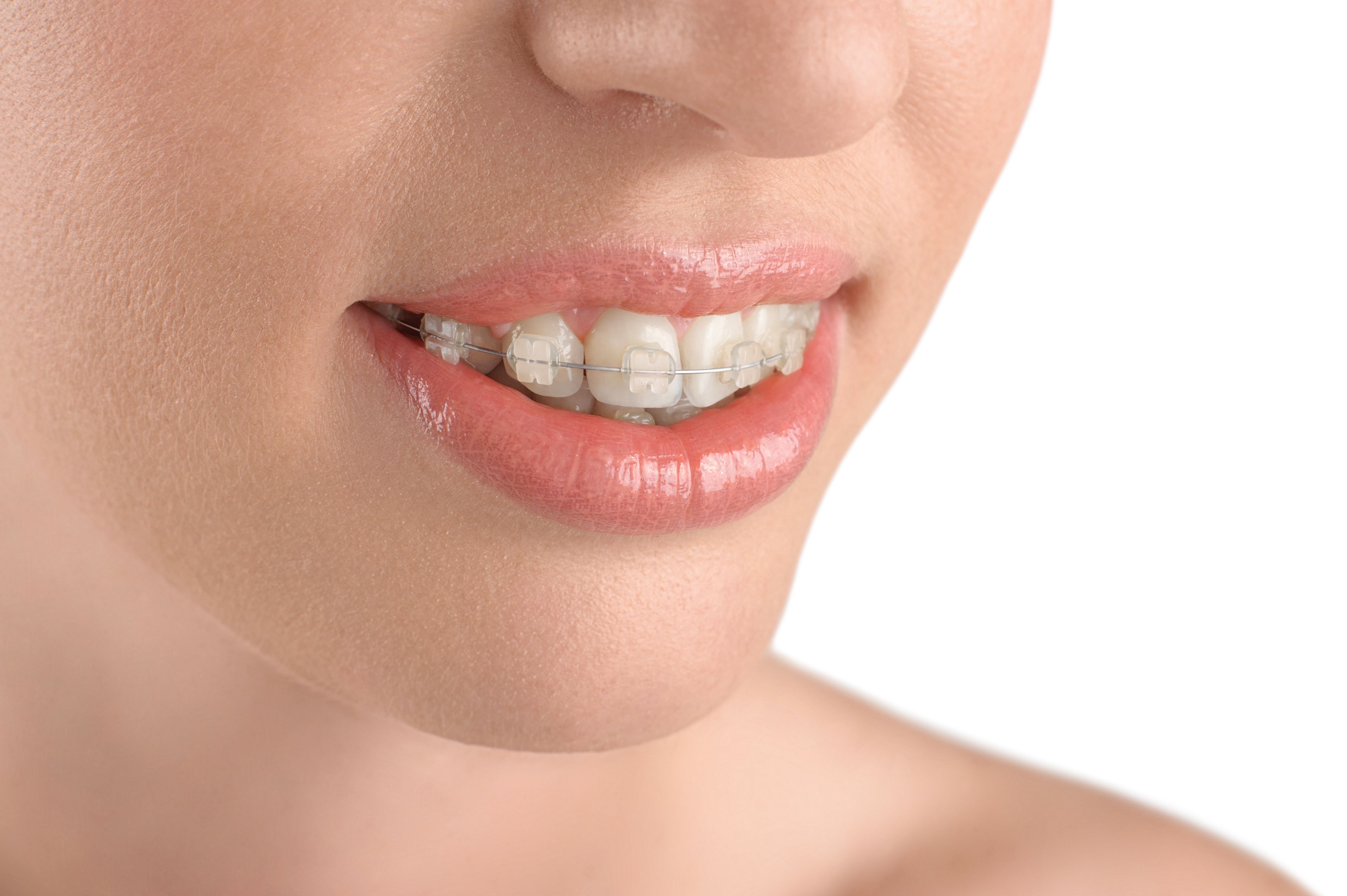 Tooth Discomfort: Managing Pain and Sores During Braces Treatment