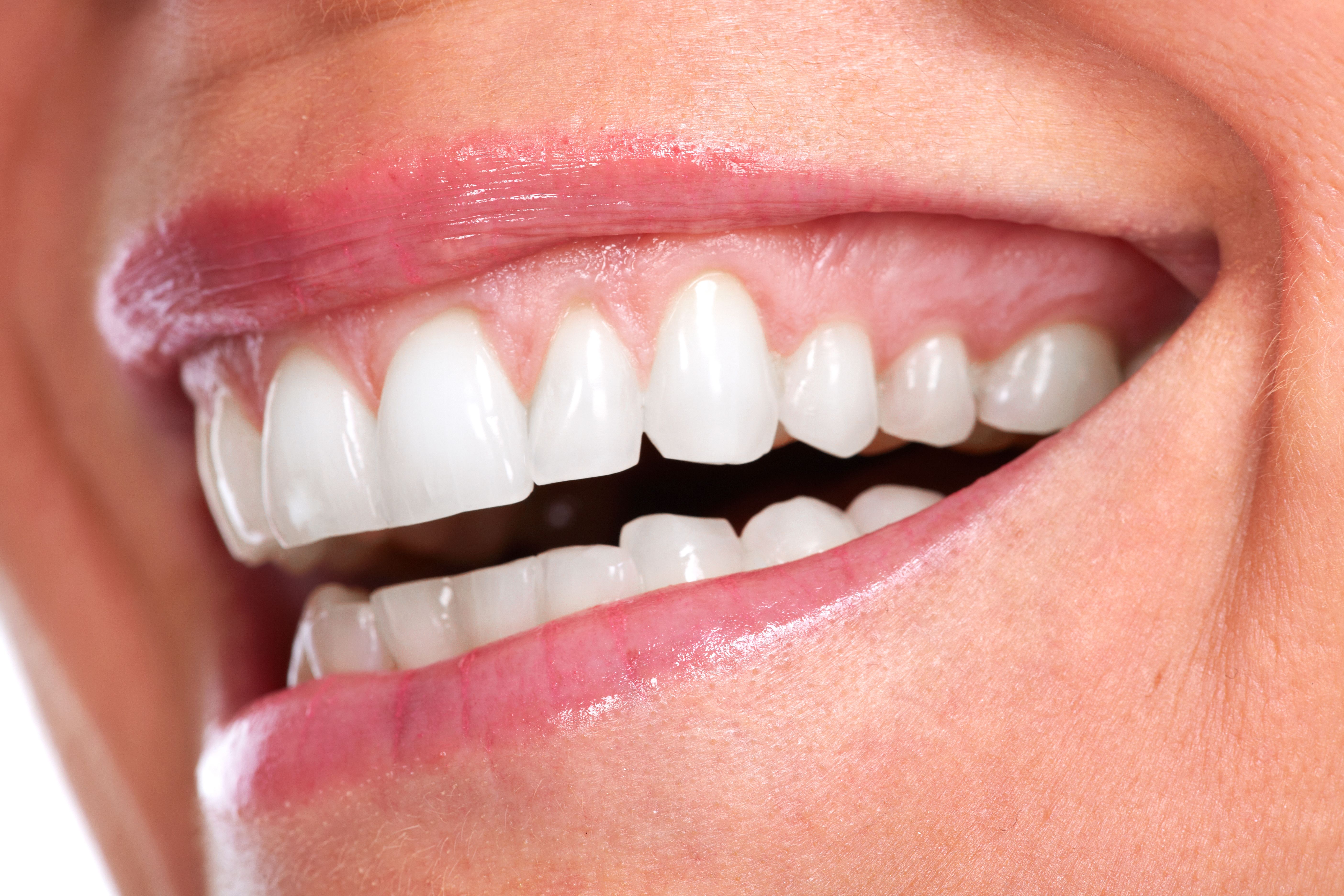 Gum shaping or recontouring can improve a gummy smile