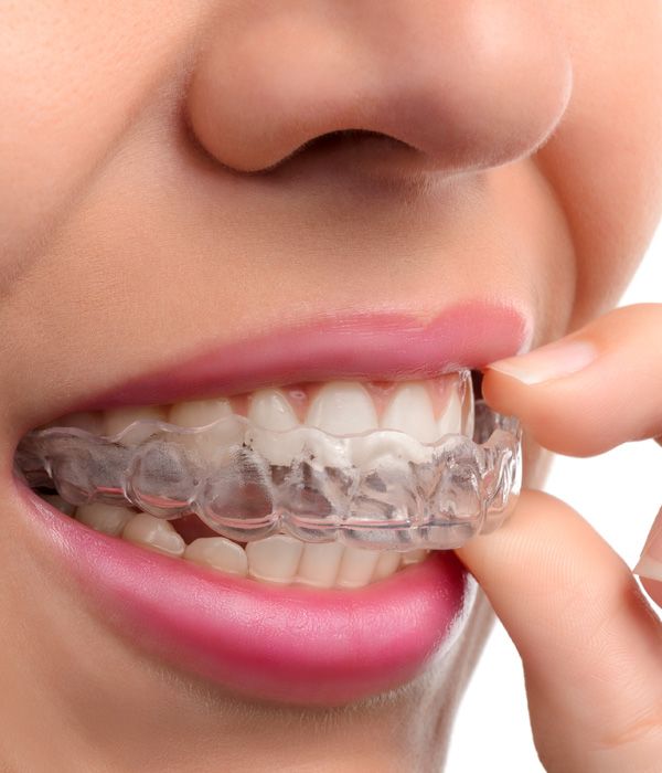 After Invisalign Treatment: Wearing a Tray at Night