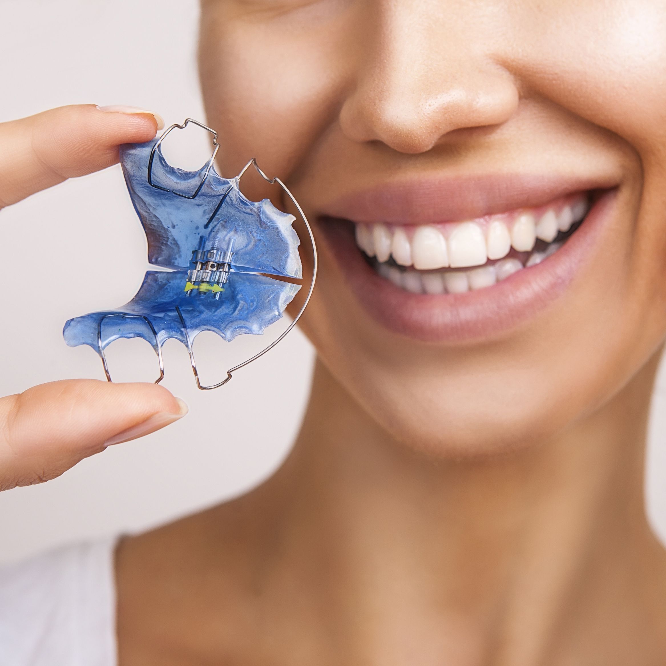 How to Whiten Your Teeth at Home with Clear Retainers or