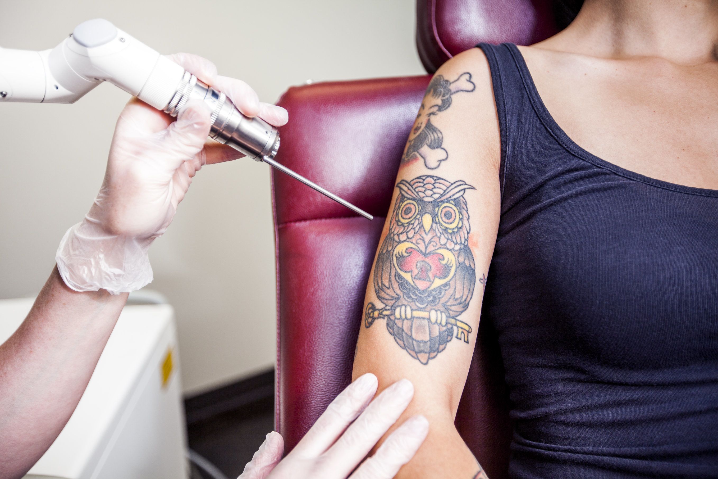 Dr. Rice Explains PicoSure Laser Tattoo Removal - AmongMen