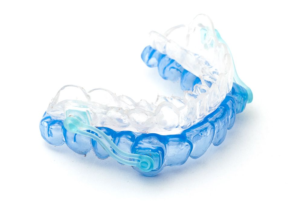 Sleep apnea oral appliance on plain white surface