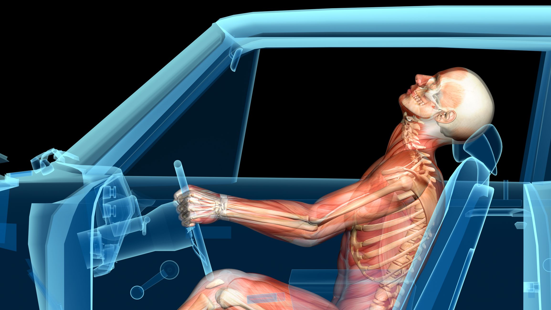 Common Car Accident Injuries Austin TX Wenholz Dow P C Trial 