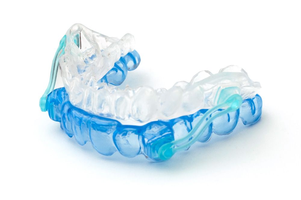 Photo of an oral appliance for TMJ disorders