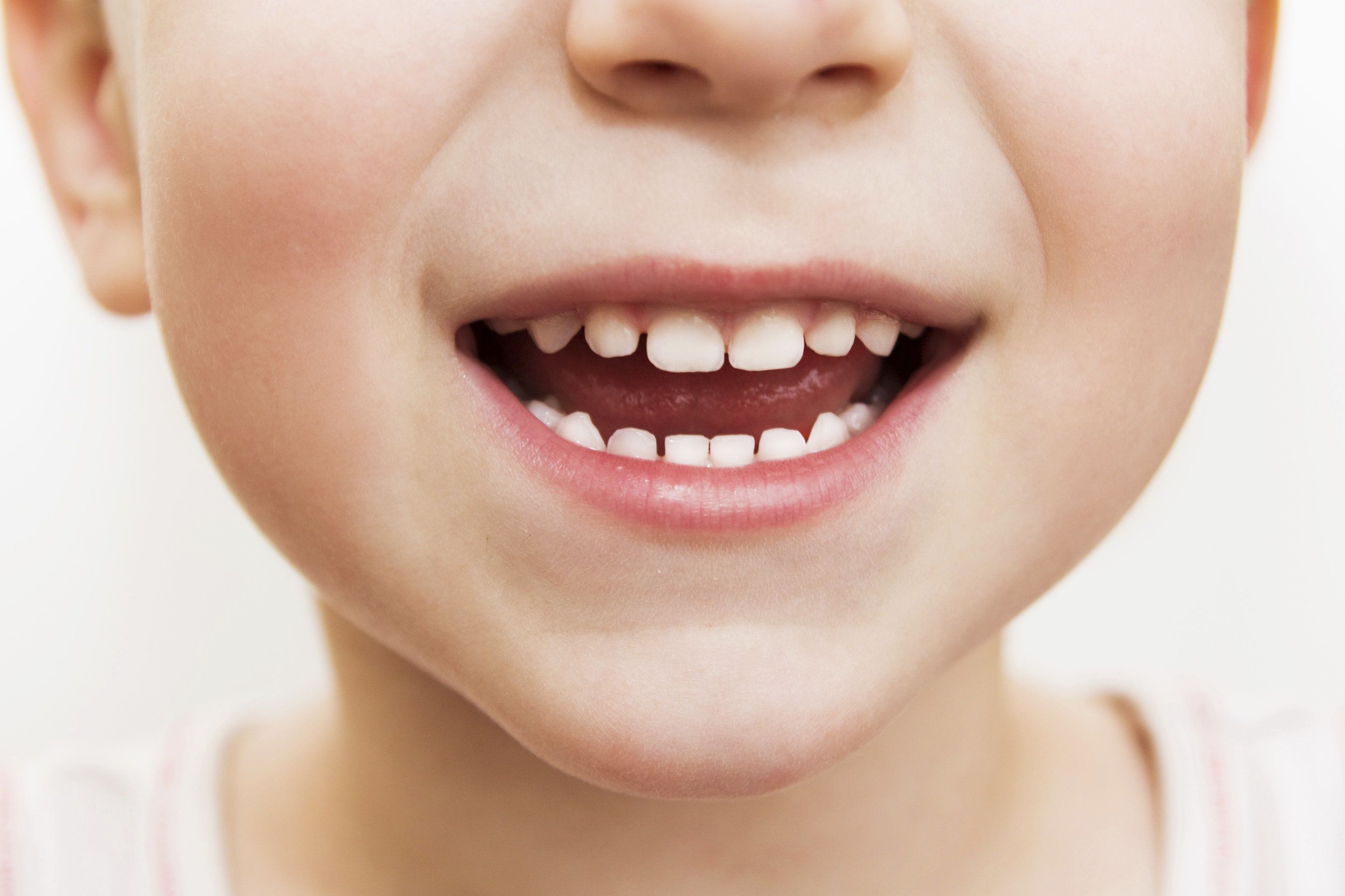 little boy with open mouth smiling with baby teeth