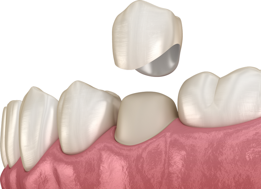 teeth translucent or transparent nutrition