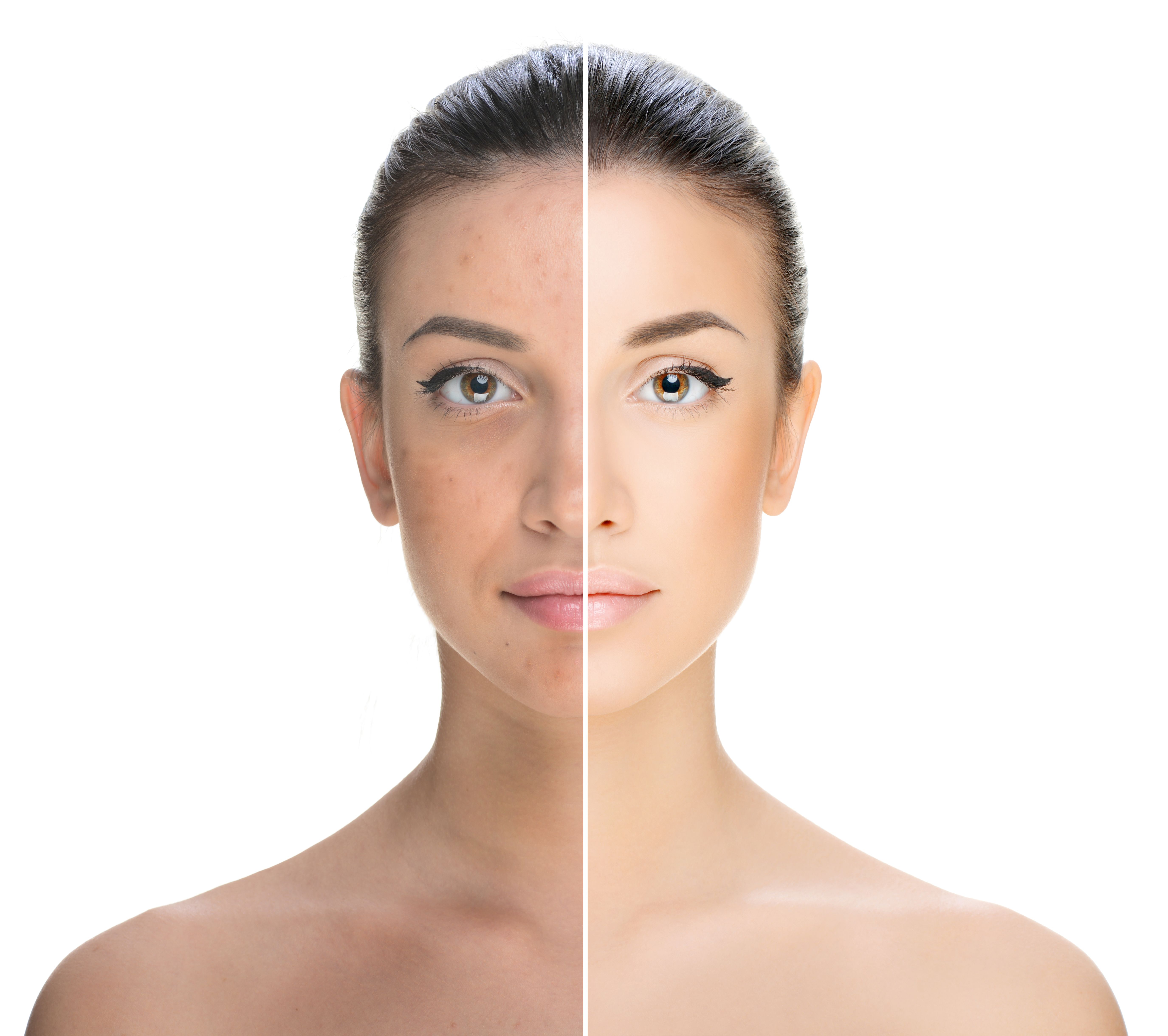 The Real Reason Why Your Face Looks Puffy Today - Advanced Dermatology &  Skin Cancer Associates