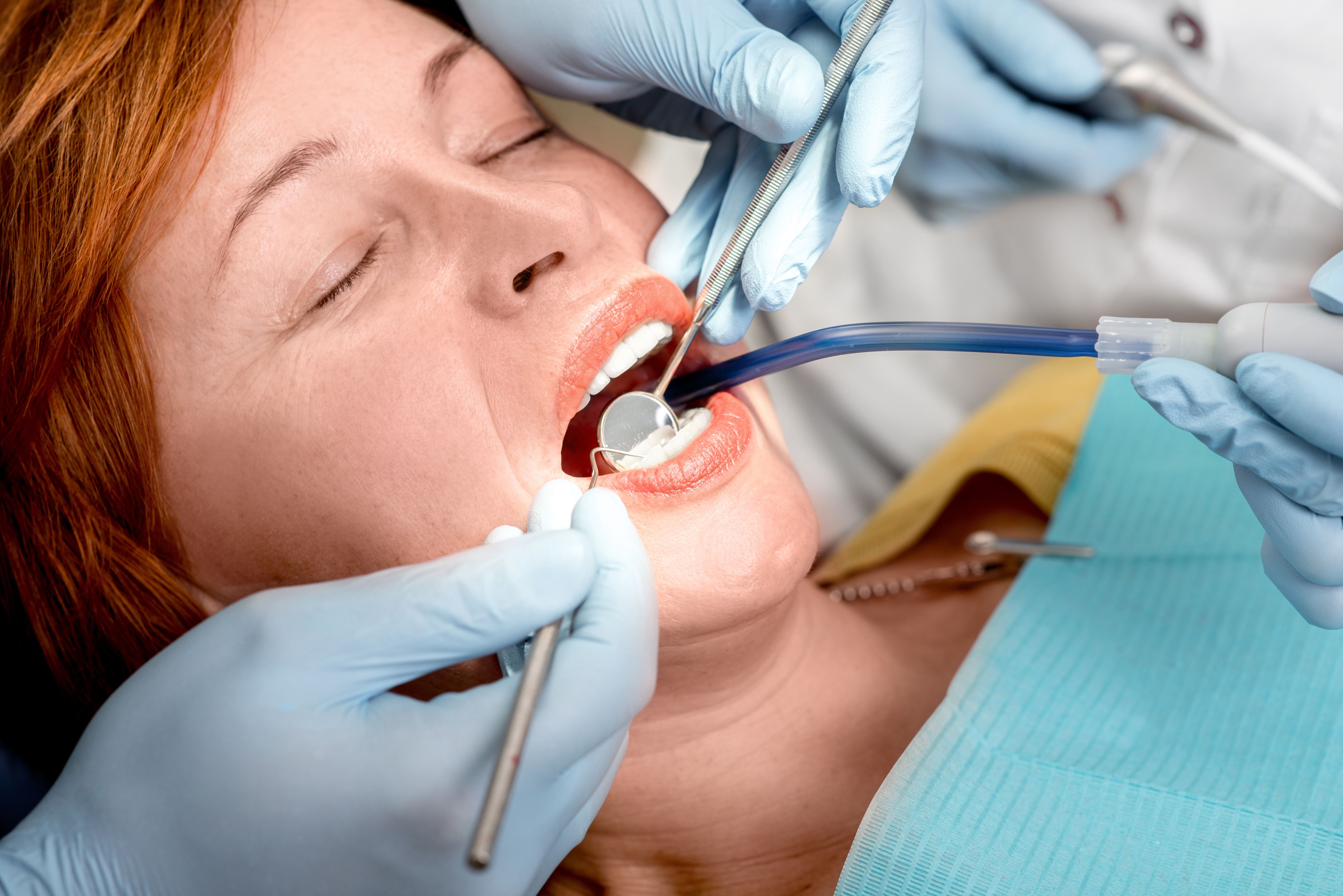 Reclined female patient has nitrous oxide administered as dental work is performed