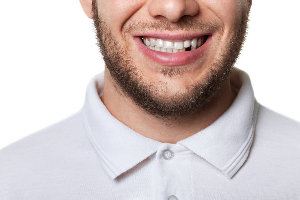 Smiling man with a missing tooth