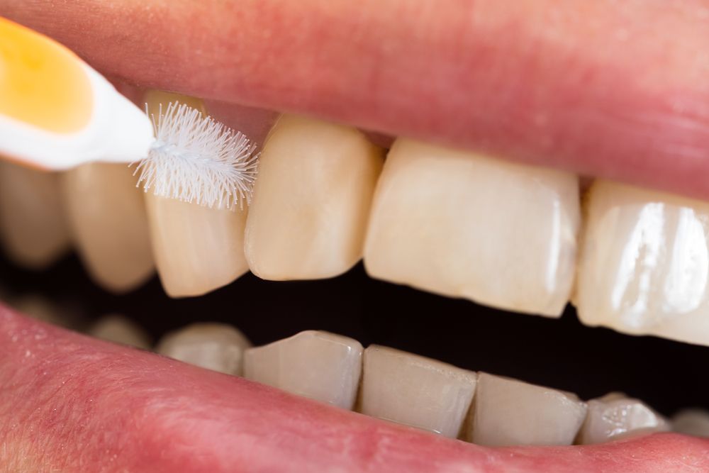 How To Master The Art Of Flossing - Soft Touch Dental