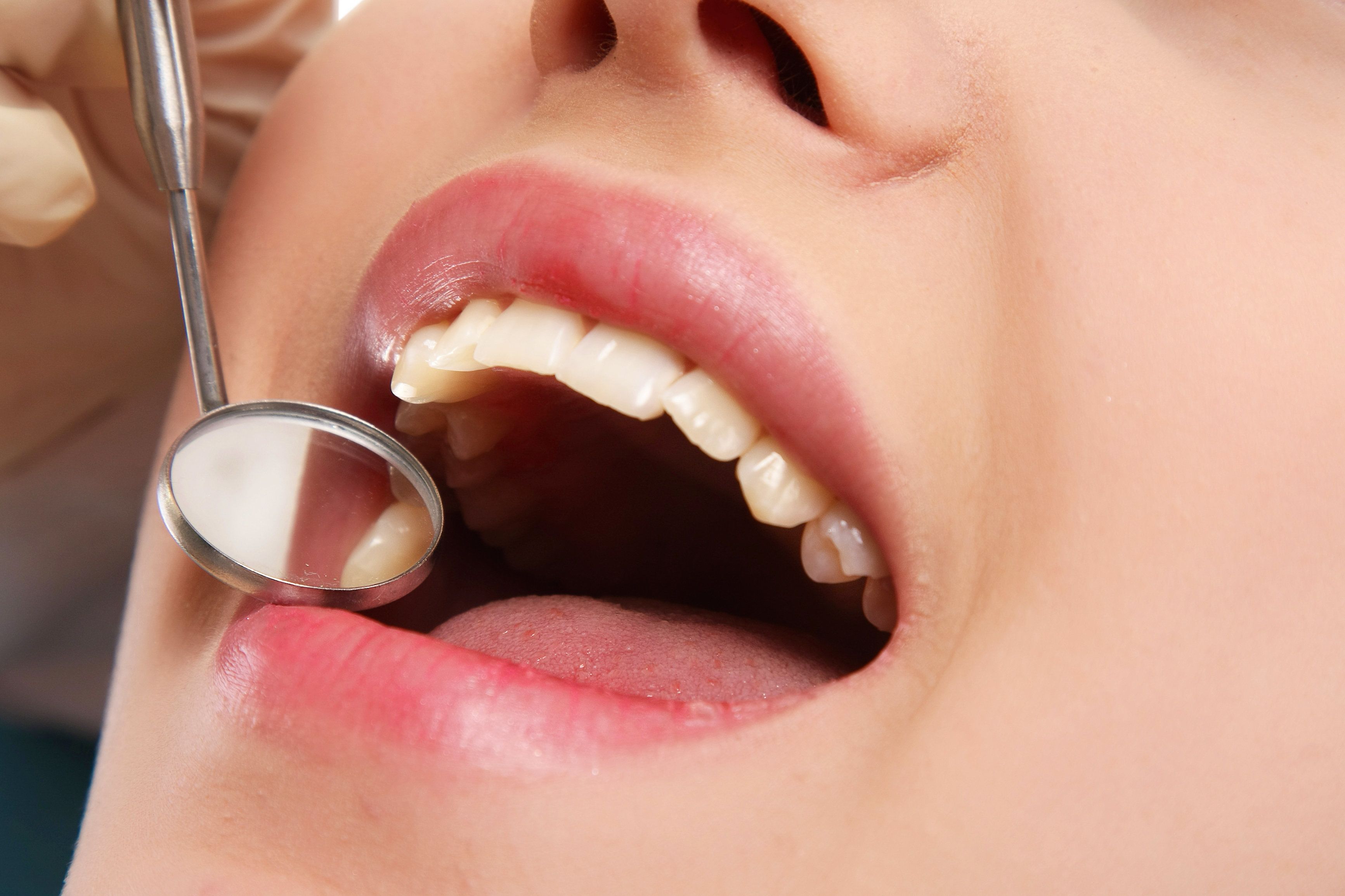 Teeth being examined with a dental mirror