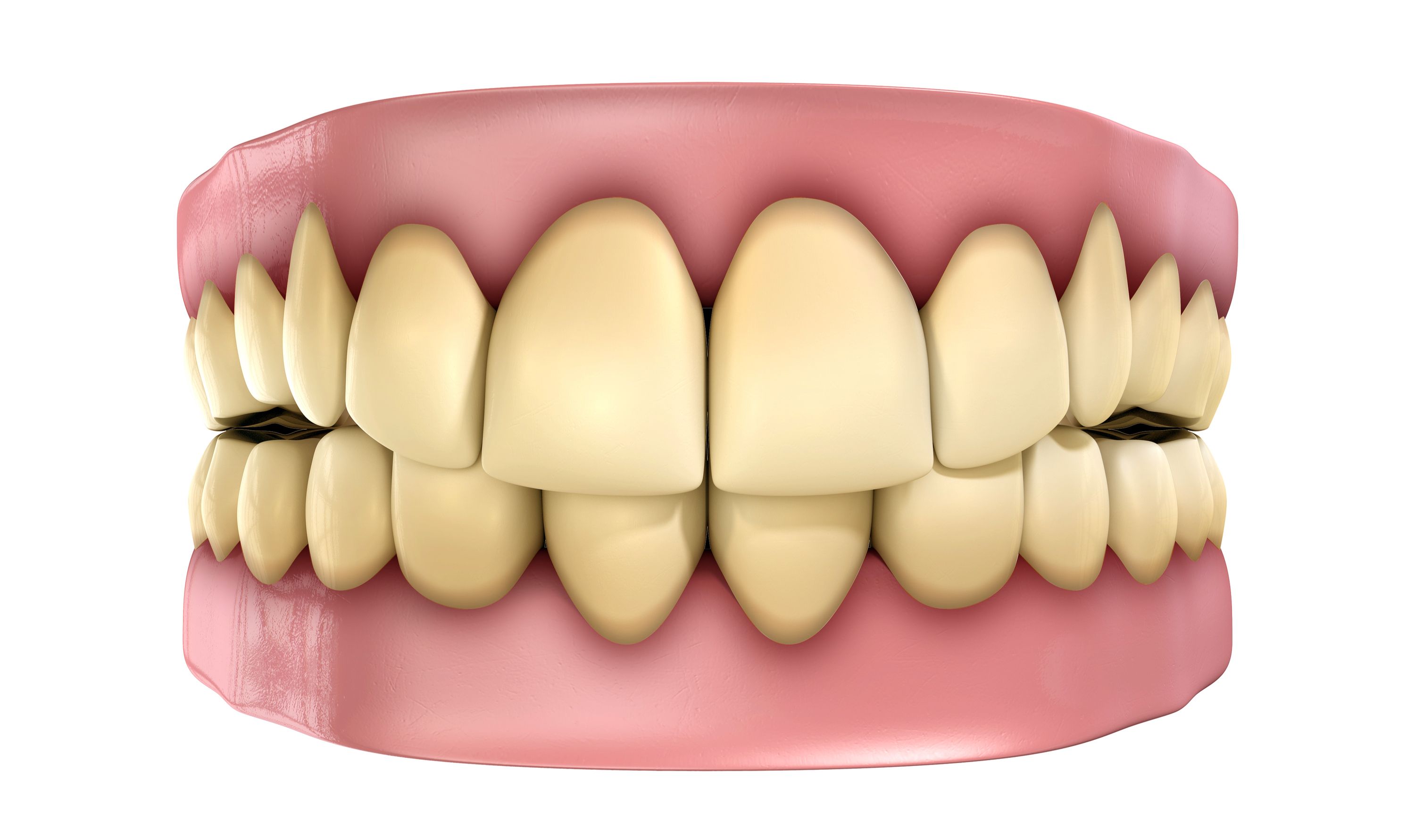 intrinsic-vs-extrinsic-tooth-stains-austin-tx