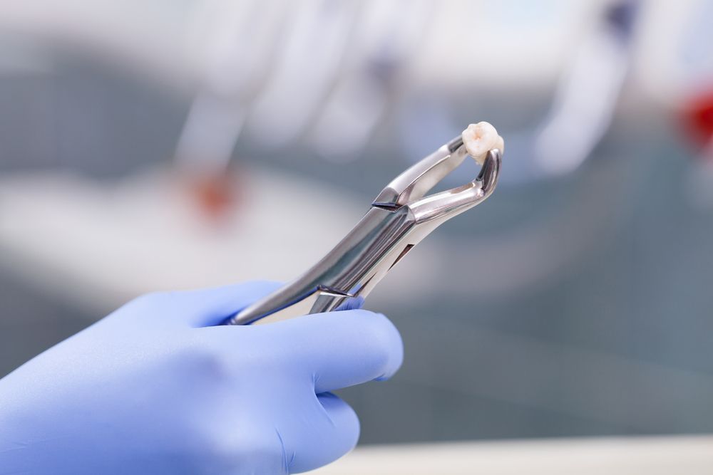 wisdom tooth