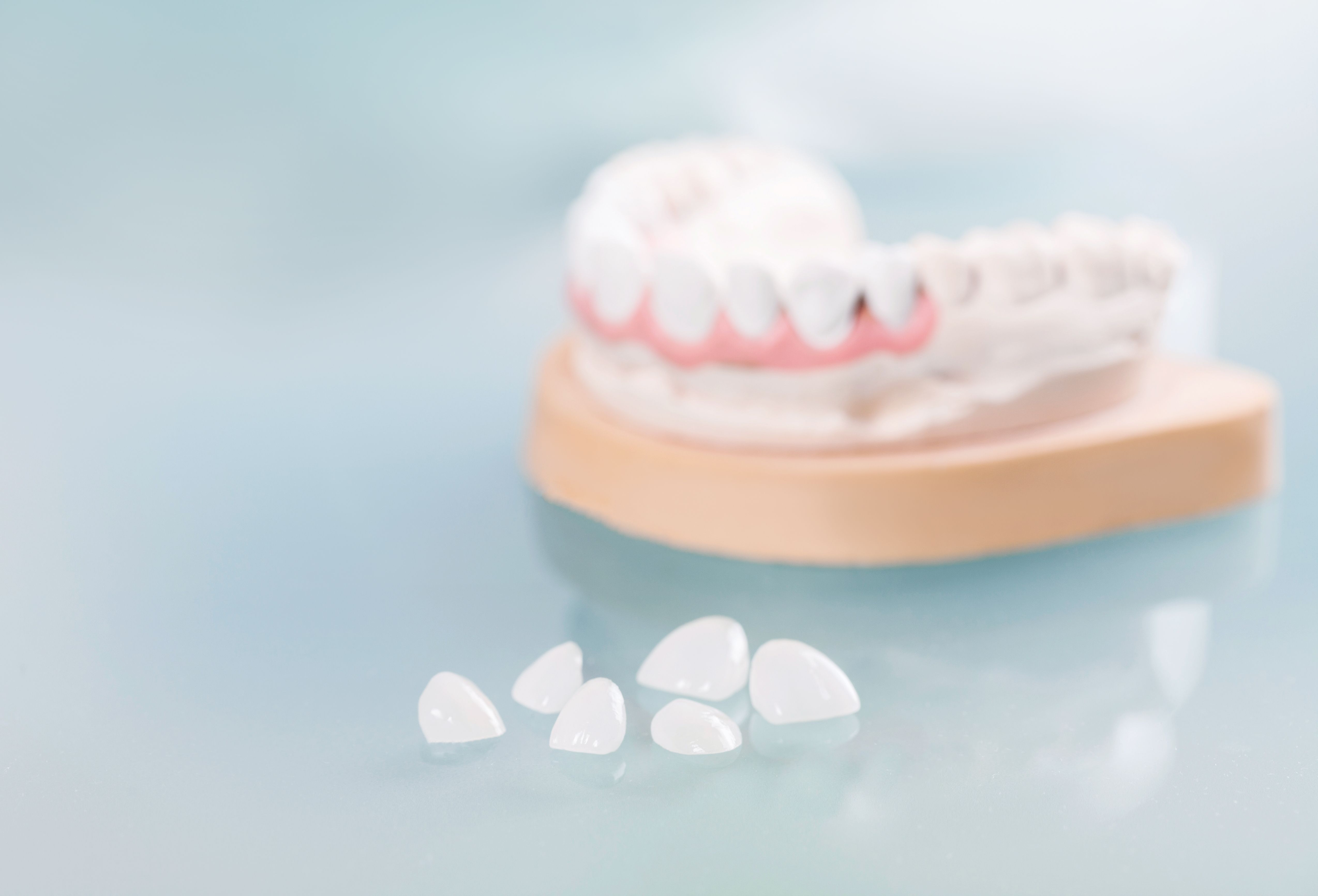 Invisalign Charlotte, NC - Ballantyne, NC - Gastonia, NC - Clear Aligners -  Advanced Dentistry of Blakeney