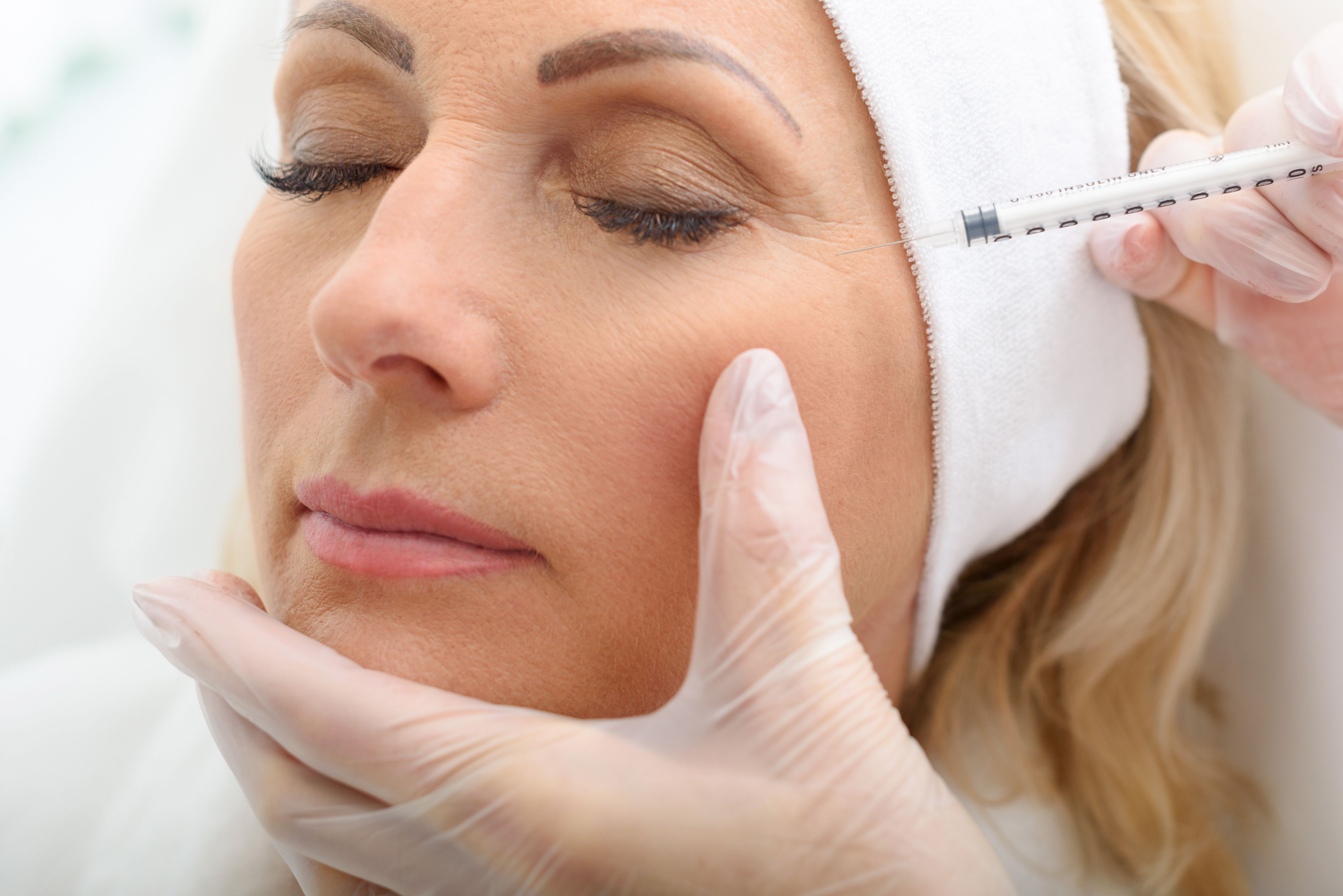  woman receiving BOTOX to soften the appearance of crow’s feet