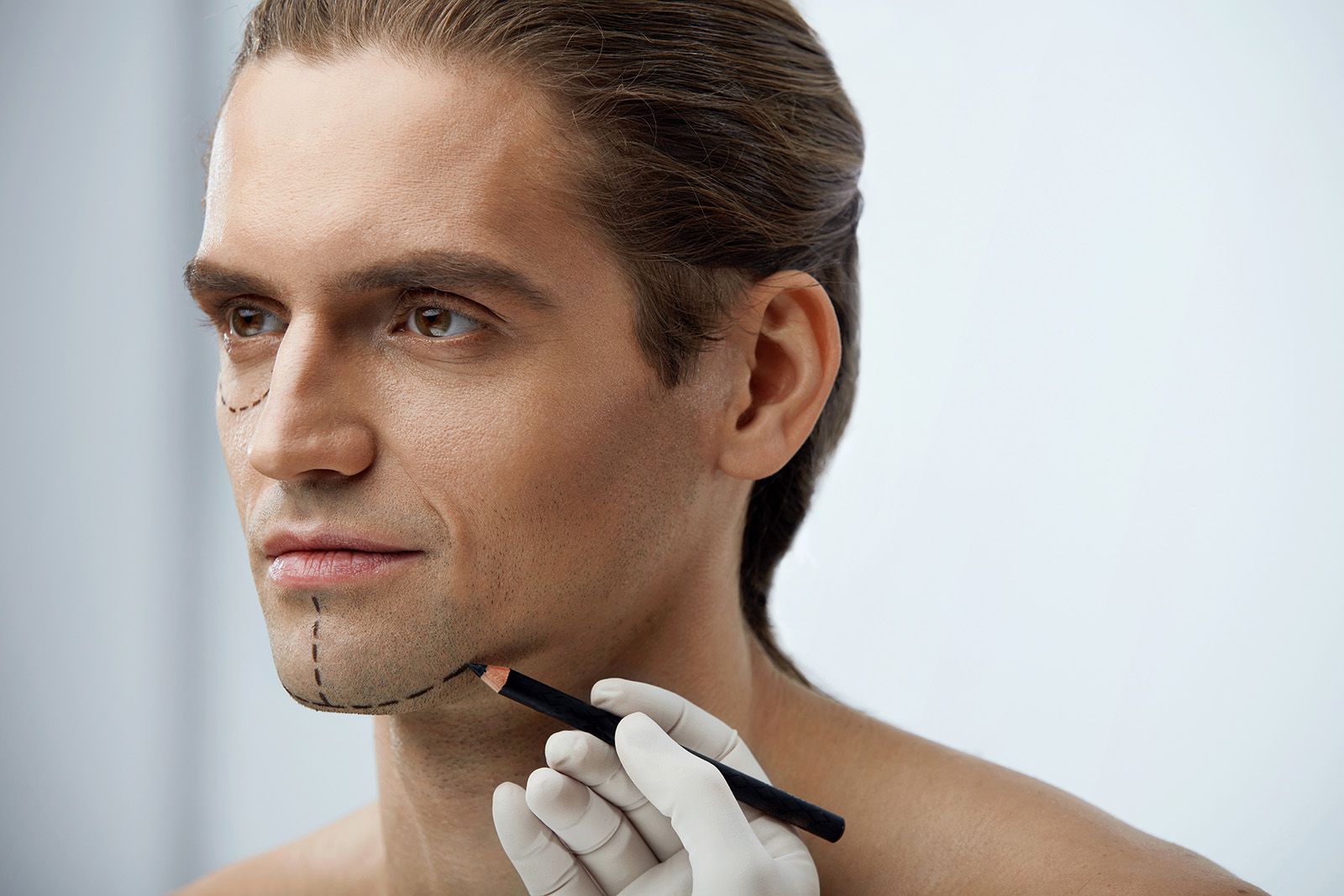 Doctor outlining treatment areas on a man's face