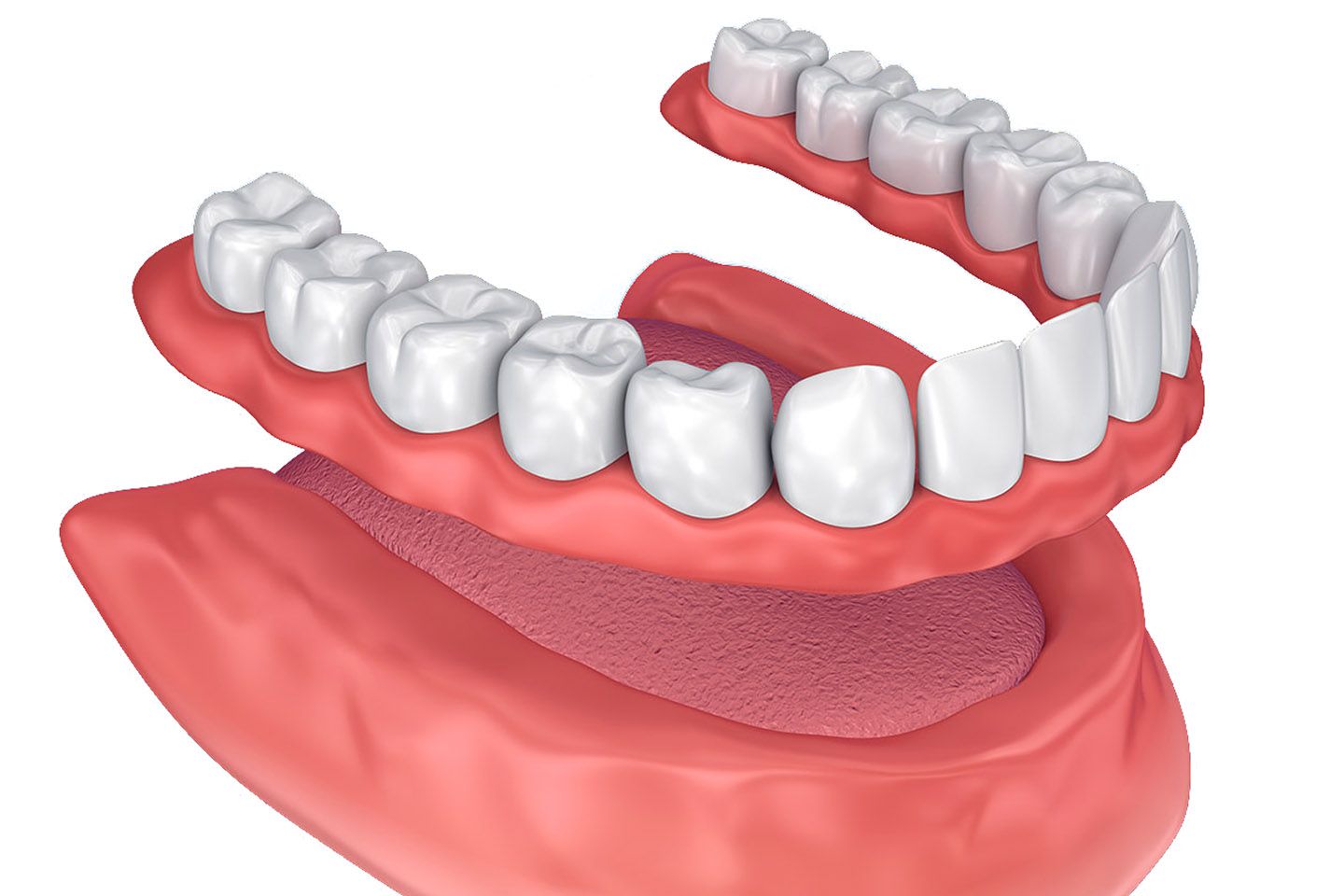 An illustration of traditional dentures