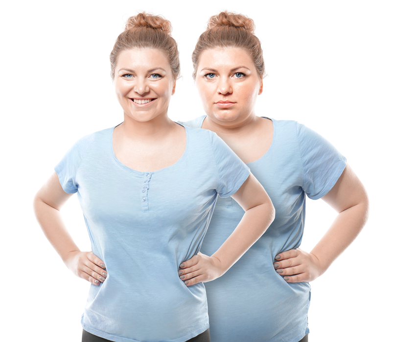 a woman before and after weight loss