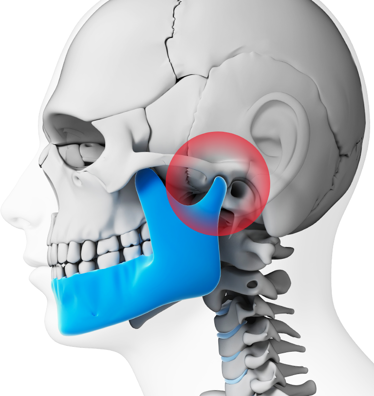 Side view of skull shows irritation near joint of jaw